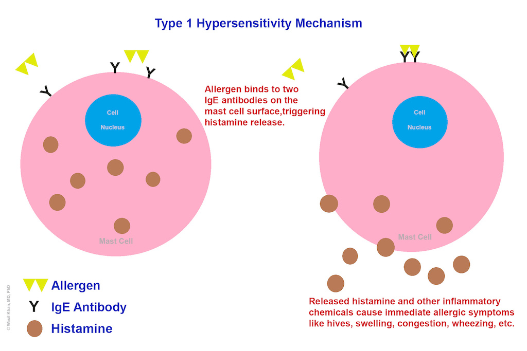 Type 1 allergic reaction illustration