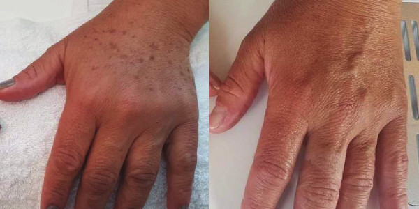 hands before and after